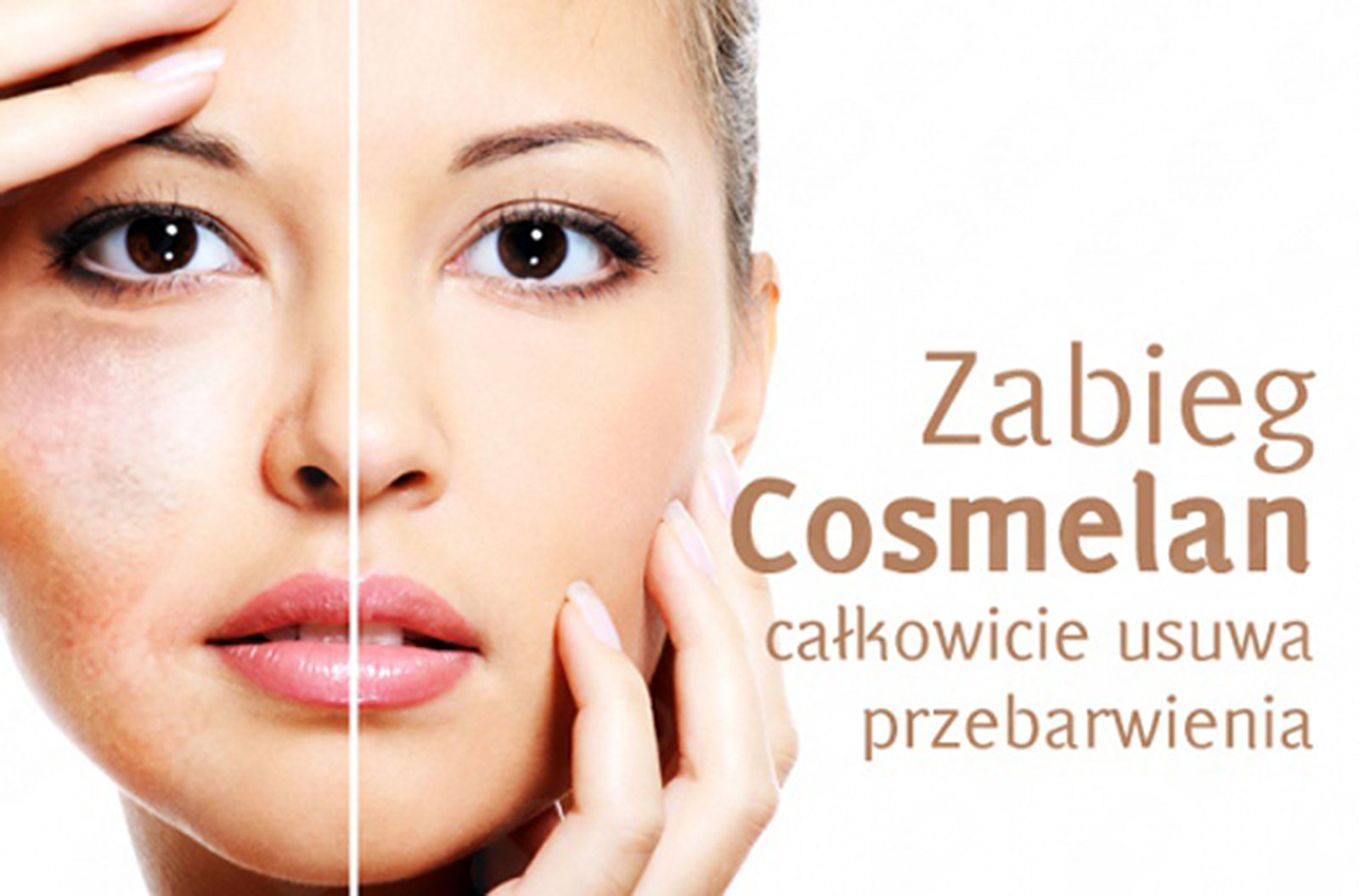 Cosmelan - całkowicie usuwa przebarwienia
